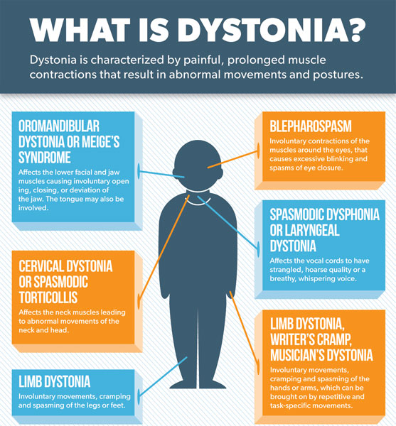 Dystonia: The Breakdown - Tyler's Hope for a Dystonia Cure