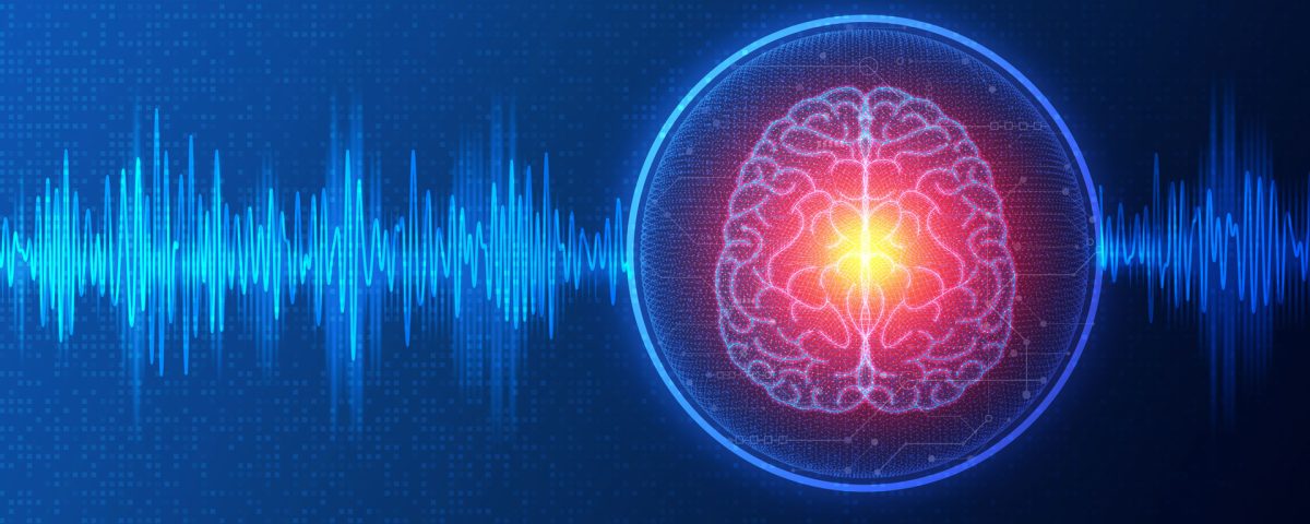 Deep brain stimulation