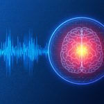 Deep brain stimulation