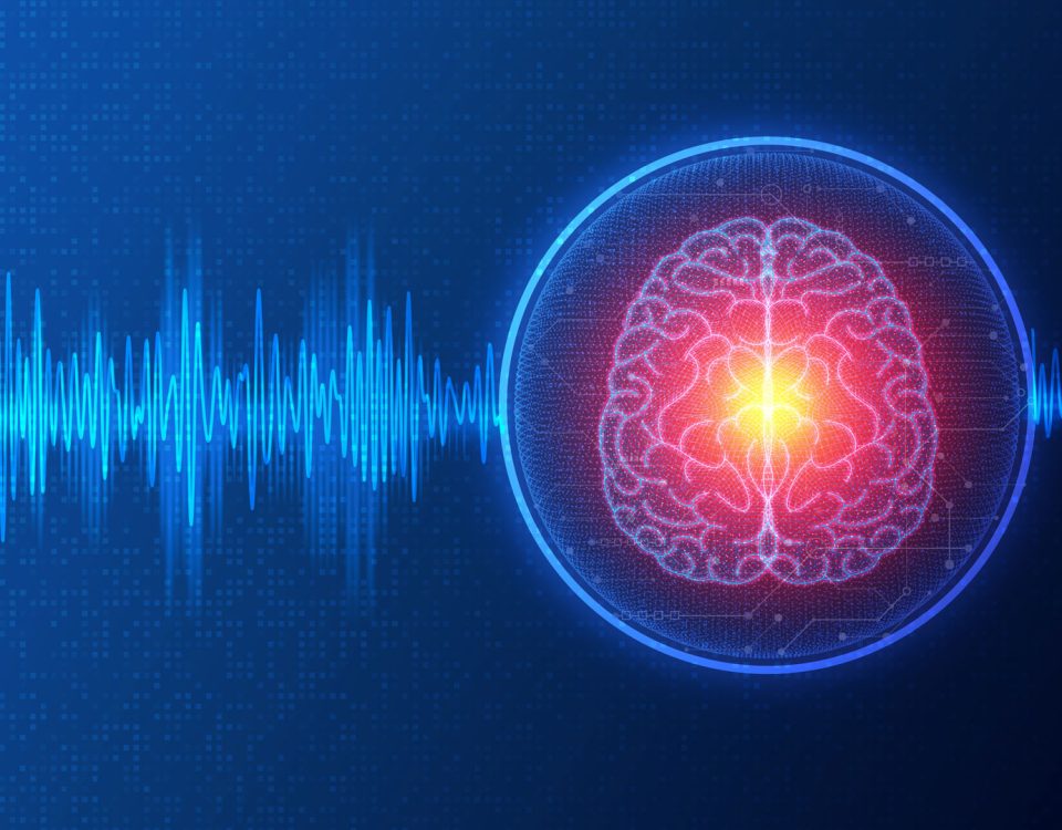 Deep brain stimulation